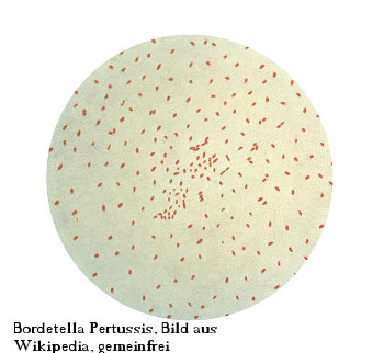 Bordetella Pertussis