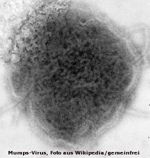 Mumps-Virus
